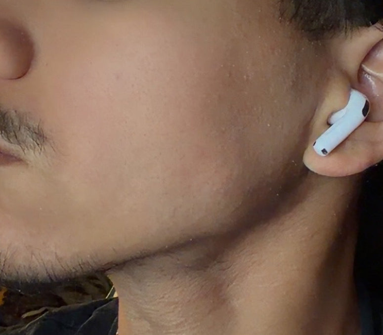 After